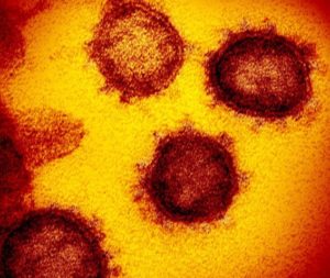 【新型コロナ】夏に終息の公算小